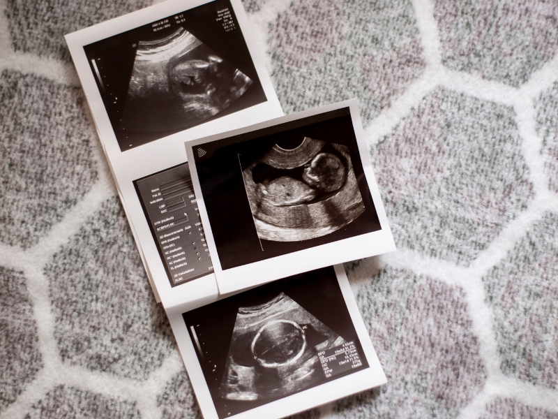 39 Các vấn đề sản khoa bà bầu có thể gặp phải trong các kỳ tam cá nguyệt.