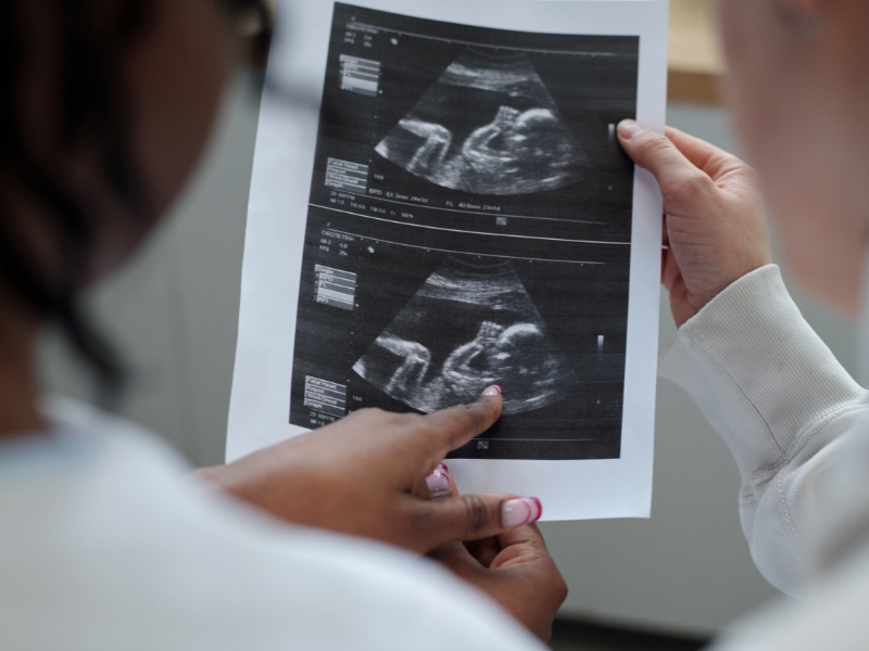 Lý do thai nhi nấc cụt?